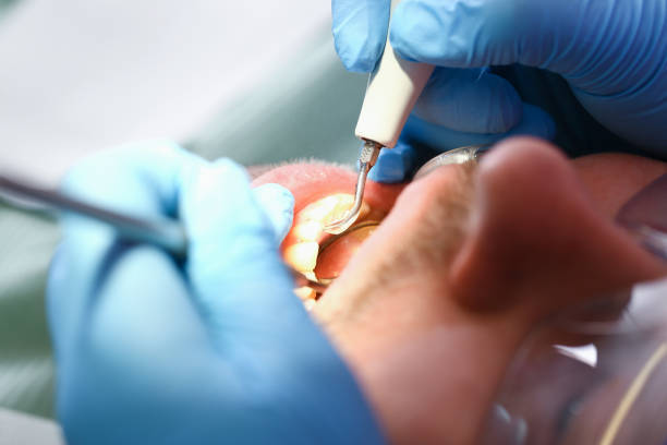 Best Emergency Treatment for Toothache in Rome, NY